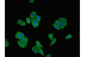 Immunofluorescent analysis of HepG2 cells using ABIN7168003 at dilution of 1:100 and Alexa Fluor 488-congugated AffiniPure Goat Anti-Rabbit IgG(H+L) (ROCK2 anticorps  (AA 1109-1388))