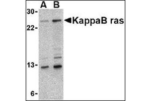 Western blot analysis of KappaB ras in 293 cell lysate with this product at (A) 2 and (B) 4 μg/ml. (NKIRAS1 anticorps  (Center))