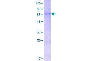 Image no. 1 for Wingless-Type MMTV Integration Site Family Member 2 (WNT2) (AA 1-360) protein (GST tag) (ABIN1325356)