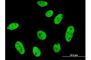Immunofluorescence of monoclonal antibody to CDKL1 on HeLa cell. (CDKL1 anticorps  (AA 259-358))