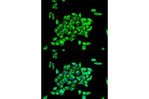 Immunofluorescence analysis of HeLa cell using TRAP1 antibody. (TRAP1 anticorps)