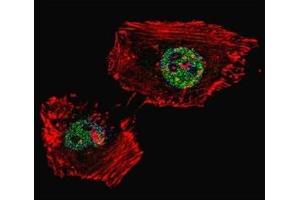 Fluorescent confocal image of HeLa cell stained with LSD1 antibody.