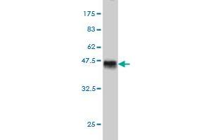 Western Blot detection against Immunogen (40. (TESK2 anticorps  (AA 405-542))