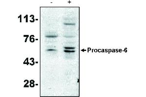 Western blot analysis using caspase-6 antibody on MCF-7 cells negative (-) and positive (+) for caspase-3 after treatment for 48 hours with thapsigargin. (Caspase 6 anticorps)