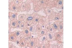 Used in DAB staining on fromalin fixed paraffin- embedded liver tissue (APMAP anticorps  (AA 62-289))