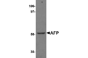 Western Blotting (WB) image for anti-alpha-Fetoprotein (AFP) (N-Term) antibody (ABIN1031219) (alpha Fetoprotein anticorps  (N-Term))
