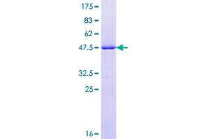 Image no. 1 for RAB7A, Member RAS Oncogene Family (RAB7A) (AA 1-207) protein (GST tag) (ABIN1317193)