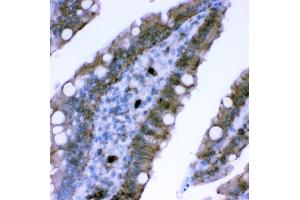 IHC analysis of Plectin using anti-Plectin antibody (ABIN3043900). (PLEC anticorps  (Middle Region))