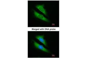 ICC/IF Image Immunofluorescence analysis of paraformaldehyde-fixed HeLa, using ATIC, antibody at 1:200 dilution. (ATIC anticorps)