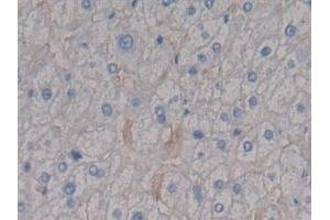 Detection of SDC1 in Human Liver Tissue using Polyclonal Antibody to Syndecan 1 (SDC1)