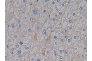 Detection of SDC1 in Human Liver Tissue using Polyclonal Antibody to Syndecan 1 (SDC1) (Syndecan 1 anticorps  (AA 23-253))