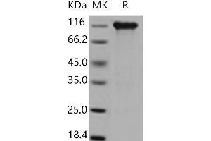 Western Blotting (WB) image for Interleukin 6 Signal Transducer (Gp130, Oncostatin M Receptor) (IL6ST) (Active) protein (His tag,Fc Tag) (ABIN7196601)