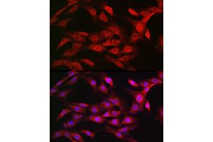 Immunofluorescence analysis of NIH/3T3 cells using KPNB1 Rabbit pAb (ABIN6134722, ABIN6142997, ABIN6142998 and ABIN6224723) at dilution of 1:100 (40x lens). (KPNB1 anticorps  (AA 250-350))