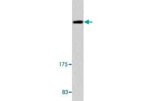 Western blot analysis of A-549 cell lysate with UBR5 polyclonal antibody .