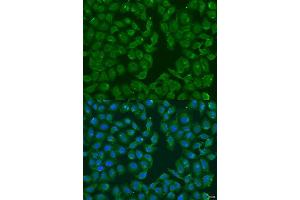 Immunofluorescence analysis of U2OS cells using MSRB3 antibody. (MSRB3 anticorps  (AA 1-185))