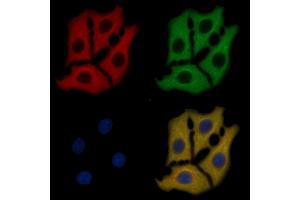 DDR1 Mouse Monoclonal Antibody staining HepG2 cells by IF/ICC.