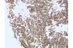 ABIN6272573 at 1/100 staining Mouse testis tissue by IHC-P.