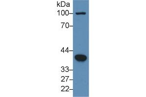 Rabbit Detection antibody from the kit in WB with Positive Control: Human hela cell lysate.