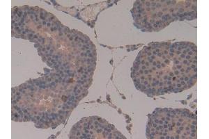 Used in DAB staining on fromalin fixed paraffin- embedded stomach tissue