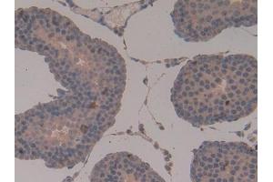 Used in DAB staining on fromalin fixed paraffin- embedded stomach tissue (OTUB1 anticorps  (AA 1-271))