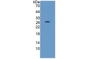 WB of Protein Standard: different control antibodies against Highly purified E.