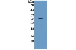 WB of Protein Standard: different control antibodies against Highly purified E. (HSP27 Kit ELISA)