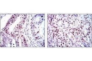 Immunohistochemistry (IHC) image for anti-Cyclin-Dependent Kinase 2 (CDK2) antibody (ABIN1106645)