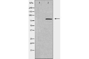Western blot analysis of extracts from COLO cells, using NCAPH antibody. (NCAPH anticorps  (Internal Region))