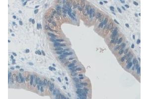 Detection of RANk in Mouse Uterus Tissue using Polyclonal Antibody to Receptor Activator Of Nuclear Factor Kappa B (RANk)