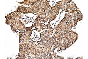 IHC analysis of TIMM29 using anti-TIMM29 antibody (ABIN7601495). (TIMM29 anticorps  (AA 37-260))