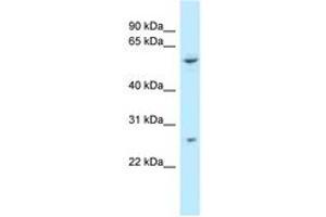 Image no. 1 for anti-Tetratricopeptide Repeat Domain 39B (TTC39B) (AA 378-427) antibody (ABIN6747851) (TTC39B anticorps  (AA 378-427))