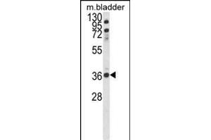 Western blot analysis of CCDC3 Antibody (C-term) (ABIN652692 and ABIN2842461) in mouse bladder tissue lysates (35 μg/lane). (CCDC3 anticorps  (C-Term))