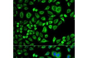 Immunofluorescence analysis of A549 cells using APOD Polyclonal Antibody (Apolipoprotein D anticorps)