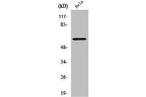 Western Blot analysis of LOVO cells using CYP2U1 Polyclonal Antibody