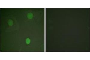 Immunofluorescence analysis of HeLa cells, using MYC (Ab-62) Antibody.
