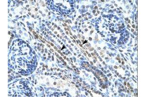 Image no. 1 for anti-Ankyrin Repeat Domain 11 (ANKRD11) (AA 57-106) antibody (ABIN202992)