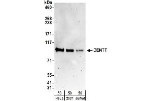 Western Blotting (WB) image for anti-TSPY-Like 2 (TSPYL2) (AA 643-693) antibody (ABIN7454573)