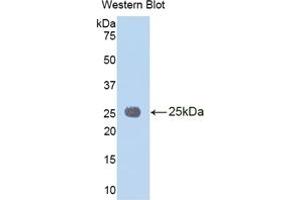 Detection of Recombinant IL1RAP, Human using Polyclonal Antibody to Interleukin 1 Receptor Accessory Protein (IL1RAP) (IL1RAP anticorps  (AA 65-249))
