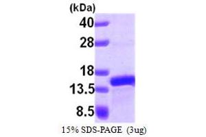 SDS-PAGE (SDS) image for Prefoldin Subunit 1 (PFDN1) (AA 14-122) protein (His tag) (ABIN6386632) (PFDN1 Protein (AA 14-122) (His tag))