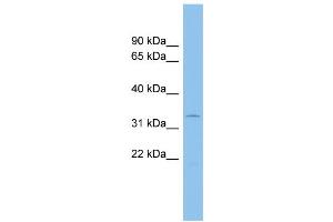 WB Suggested Anti-ACP5 Antibody Titration:  0.