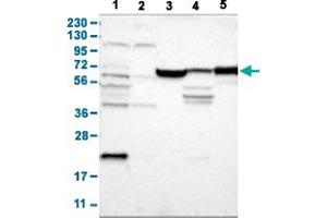 Western Blot analysis with JPH1 polyclonal antibody . (Junctophilin 1 anticorps  (AA 387-512))