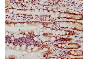 IHC image of ABIN7127487 diluted at 1:77.