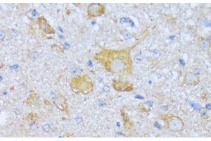 Immunohistochemistry of paraffin-embedded Mouse spinal cord using ACADSB Polyclonal Antibody at dilution of 1:100 (40x lens).