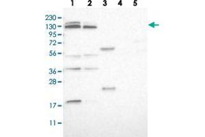 Western blot analysis of Lane 1: RT-4, Lane 2: U-251 MG, Lane 3: Human Plasma, Lane 4: Liver, Lane 5: Tonsil with SLC38A10 polyclonal antibody  at 1:250-1:500 dilution. (SLC38A10 anticorps)