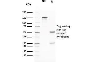 SDS-PAGE Analysis Purified RAD51 Mouse Monoclonal Antibody (RAD51/2765. (RAD51 anticorps  (AA 1-134))