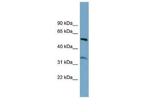 THNSL2 antibody used at 1 ug/ml to detect target protein. (THNSL2 anticorps)