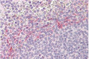 anti-Apolipoprotein B mRNA Editing Enzyme, Catalytic Polypeptide-Like 3D (APOBEC3D) (AA 61-74) antibody