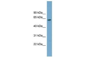 CNDP2 antibody used at 1 ug/ml to detect target protein. (CNDP2 anticorps)