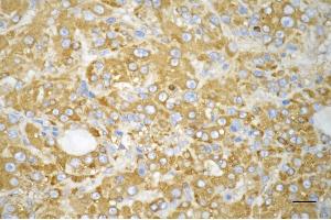 anti-WD Repeat Domain 1 (WDR1) antibody