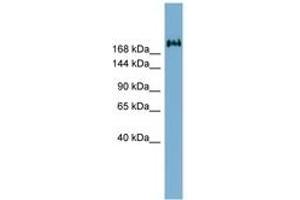 Image no. 1 for anti-Transmembrane Protein 2 (TMEM2) (AA 1187-1236) antibody (ABIN6741962) (TMEM2 anticorps  (AA 1187-1236))